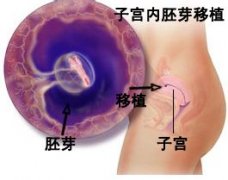 代怀孕的概念及发展过程 代怀孕的概念及发展过程